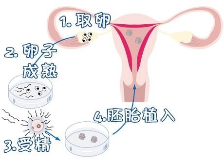 极光生殖